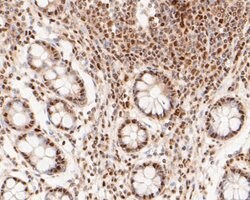 Invitrogen MTA2 Monoclonal Antibody (17A1) 100 &mu;L; Unconjugated:Antibodies,