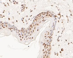 Invitrogen MTA2 Monoclonal Antibody (17A1) 100 &mu;L; Unconjugated:Antibodies,