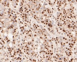Invitrogen MTA2 Monoclonal Antibody (17A1) 100 &mu;L; Unconjugated:Antibodies,