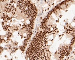 Invitrogen MTA2 Monoclonal Antibody (17A1) 100 &mu;L; Unconjugated:Antibodies,