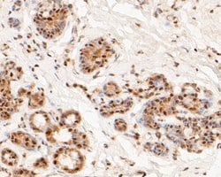Invitrogen MTA2 Monoclonal Antibody (17A1) 100 &mu;L; Unconjugated:Antibodies,