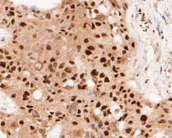Invitrogen MTA2 Monoclonal Antibody (17A1) 100 &mu;L; Unconjugated:Antibodies,