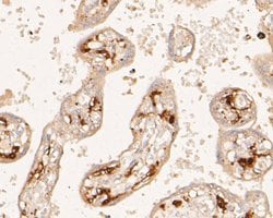 Invitrogen Factor XIII A Monoclonal Antibody (16D3) 100 &mu;L; Unconjugated:Antibodies,
