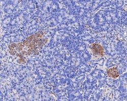 Invitrogen TRIM72 Monoclonal Antibody (A1D4) 100 &mu;L; Unconjugated:Antibodies,