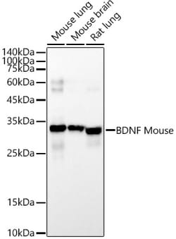 Invitrogen BDNF Monoclonal Antibody (1O9E9) 100 &mu;L; Unconjugated:Antibodies,