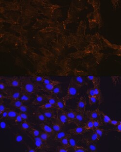 Invitrogen beta Catenin Recombinant Rabbit Monoclonal Antibody (6A3P2)