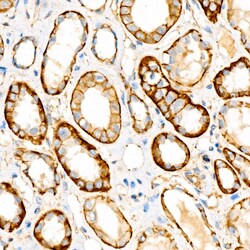 Invitrogen beta Catenin Recombinant Rabbit Monoclonal Antibody (6A3P2)
