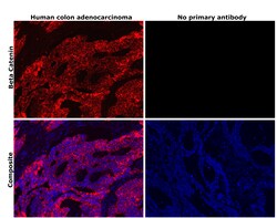 Invitrogen beta Catenin Recombinant Rabbit Monoclonal Antibody (6A3P2)