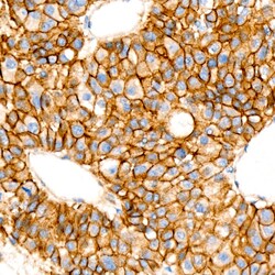 Invitrogen beta Catenin Recombinant Rabbit Monoclonal Antibody (6A3P2)