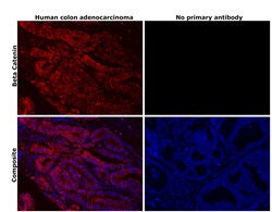 Invitrogen beta Catenin Recombinant Rabbit Monoclonal Antibody (6A3P2)