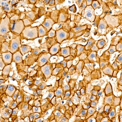 Invitrogen beta Catenin Recombinant Rabbit Monoclonal Antibody (6A3P2)