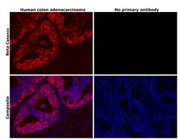 Invitrogen beta Catenin Recombinant Rabbit Monoclonal Antibody (6A3P2)