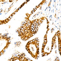 Invitrogen beta Catenin Recombinant Rabbit Monoclonal Antibody (6A3P2)