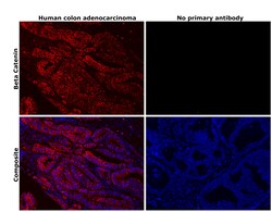 Invitrogen beta Catenin Recombinant Rabbit Monoclonal Antibody (6A3P2)