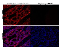 Invitrogen beta Catenin Recombinant Rabbit Monoclonal Antibody (6A3P2)