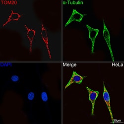 Invitrogen TOM20 Recombinant Rabbit Monoclonal Antibody (10G6I8) 100 &mu;L;
