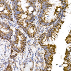 Invitrogen TOM20 Recombinant Rabbit Monoclonal Antibody (10G6I8) 100 &mu;L;