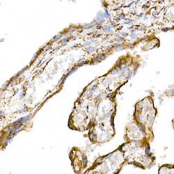 Invitrogen TOM20 Recombinant Rabbit Monoclonal Antibody (10G6I8) 100 &mu;L;