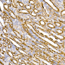 Invitrogen TOM20 Recombinant Rabbit Monoclonal Antibody (10G6I8) 100 &mu;L;