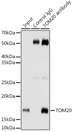 Invitrogen TOM20 Recombinant Rabbit Monoclonal Antibody (10G6I8) 100 &mu;L;