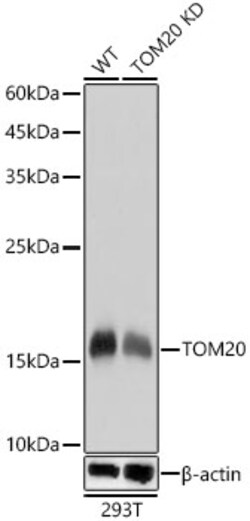 Invitrogen TOM20 Recombinant Rabbit Monoclonal Antibody (10G6I8) 100 &mu;L;