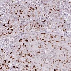 Invitrogen ATAD2 Monoclonal Antibody (CL0182) 100 μL; Unconjugated:Antibodies,