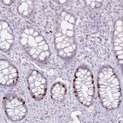 Invitrogen ATAD2 Monoclonal Antibody (CL0182) 100 μL; Unconjugated:Antibodies,