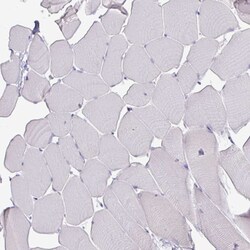 Invitrogen ATAD2 Monoclonal Antibody (CL0182) 100 μL; Unconjugated:Antibodies,