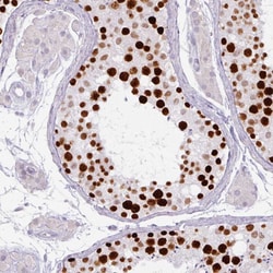 Invitrogen ATAD2 Monoclonal Antibody (CL0182) 100 μL; Unconjugated:Antibodies,