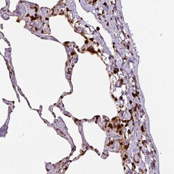 Annexin A1 Monoclonal Antibody (CL0199):Antibodies, Monoclonal