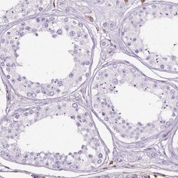 Annexin A1 Monoclonal Antibody (CL0199):Antibodies, Monoclonal