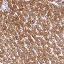 Invitrogen SLC27A5 Monoclonal Antibody (CL0216) 100 &mu;L; Unconjugated:Antibodies,