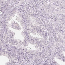 Invitrogen SLC27A5 Monoclonal Antibody (CL0216) 100 &mu;L; Unconjugated:Antibodies,