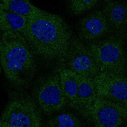 Invitrogen IDH1 Monoclonal Antibody (CL0219) 100 &mu;L; Unconjugated:Antibodies,