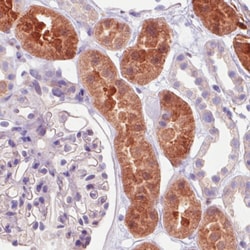 Invitrogen IDH1 Monoclonal Antibody (CL0219) 100 &mu;L; Unconjugated:Antibodies,
