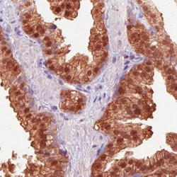 Invitrogen IDH1 Monoclonal Antibody (CL0219) 100 &mu;L; Unconjugated:Antibodies,