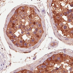 Invitrogen IDH1 Monoclonal Antibody (CL0219) 100 &mu;L; Unconjugated:Antibodies,