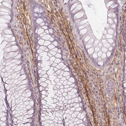 Invitrogen Fibrillin 1 Monoclonal Antibody (CL0226) 100 &mu;L; Unconjugated:Antibodies,