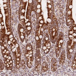 Invitrogen SDHB Monoclonal Antibody (CL0347) 100 &mu;L; Unconjugated:Antibodies,