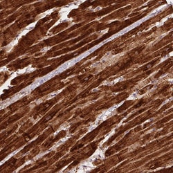 Invitrogen SDHB Monoclonal Antibody (CL0347) 100 &mu;L; Unconjugated:Antibodies,