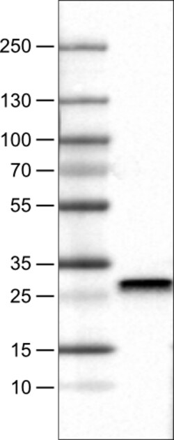 Invitrogen SDHB Monoclonal Antibody (CL0347) 100 &mu;L | Buy Online | Invitrogen&trade; | Fisher Scientific