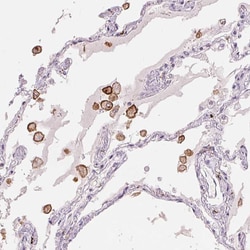 Invitrogen CD206 Monoclonal Antibody (CL0387) 100 &mu;L; Unconjugated:Antibodies,