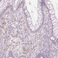 Invitrogen CD206 Monoclonal Antibody (CL0387) 100 &mu;L; Unconjugated:Antibodies,