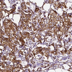 Invitrogen Metadherin Monoclonal Antibody (CL0397) 100 &mu;L; Unconjugated:Antibodies,