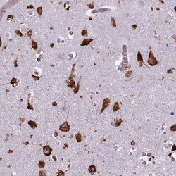 Invitrogen Metadherin Monoclonal Antibody (CL0397) 100 &mu;L; Unconjugated:Antibodies,