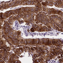 Invitrogen Metadherin Monoclonal Antibody (CL0397) 100 &mu;L; Unconjugated:Antibodies,