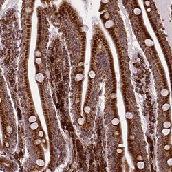 Invitrogen Metadherin Monoclonal Antibody (CL0397) 100 &mu;L; Unconjugated:Antibodies,
