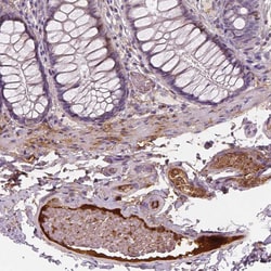 Apolipoprotein A4 Monoclonal Antibody (CL0468):Antibodies, Monoclonal