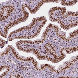 Invitrogen HDAC1 Monoclonal Antibody (CL0510) 100 &mu;L; Unconjugated:Antibodies,