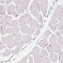 Invitrogen HDAC1 Monoclonal Antibody (CL0510) 100 &mu;L; Unconjugated:Antibodies,